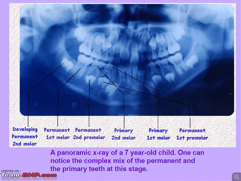 Calling doctors/dentists/specialists on Team-BHP to provide free consultations-2.jpg