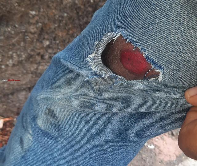 How I learnt the importance of wearing riding gear the hard way 